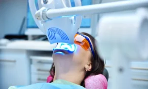 The Benefits of Professional Teeth Whitening in Fort Wayne, IN